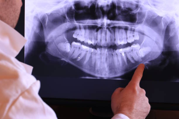Best Cracked Tooth Emergency Dentist  in Lagrange, OH
